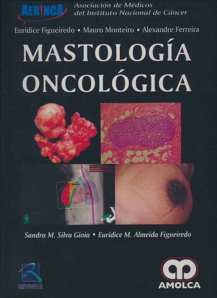 Kniha MASTOLOGIA ONCOLOGICA MONTEIRO