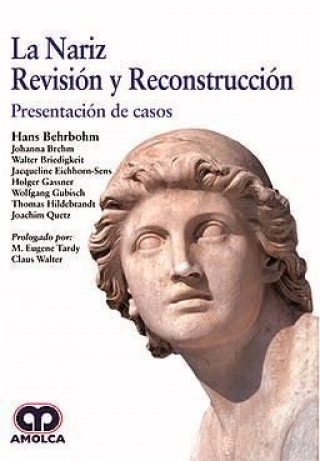 Kniha NARIZ REVISION Y RECONSTRUCCION PRESENTACION DE CASOS BEHRBOHM