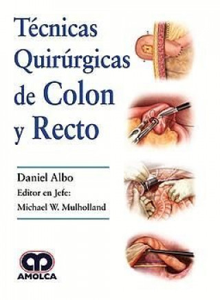 Книга Técnicas Quirúrgicas de Colon y Recto ALBO