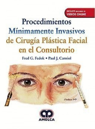 Könyv PROCEDIMIENTOS MINIMAMENTE INVASIVOS DE CIRUGIA PLASTICA FEDOK