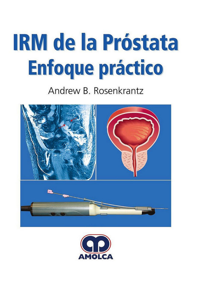 Boek IRM de la Próstata. Enfoque Práctico ROSENKRANTZ