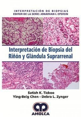 Kniha Interpretación de Biopsia del Riñón y Glándula Suprarrenal TICKOO