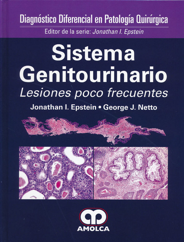 Książka SISTEMA GENITOURINARIO. LESIONES POCO FRECUENTES EPSTEIN