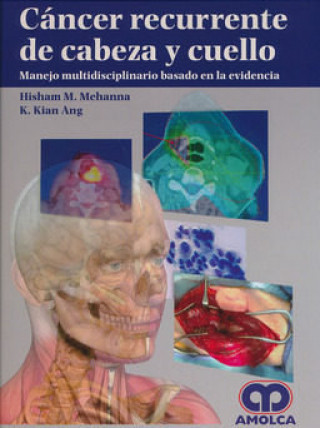Knjiga CANCER RECURRENTE DE CABEZA Y CUELLO MEHANNA