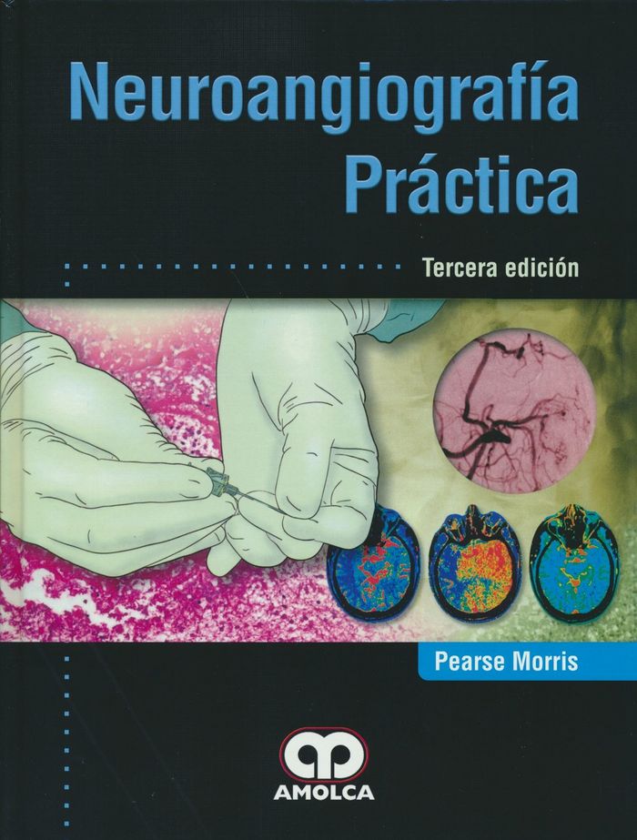 Buch NEUROANGIOGRAFIA PRACTICA MORRIS