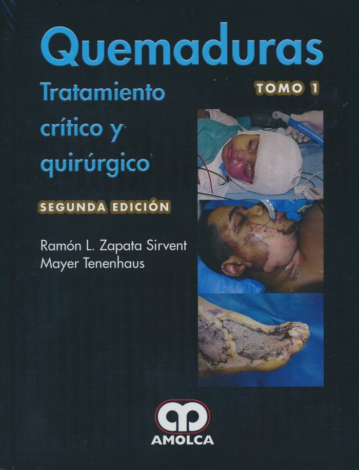 Kniha QUEMADURAS TRATAMIENTO CRITICO Y QUIRURGICO 2 TOMOS ZAPATA