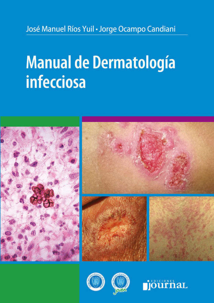 Kniha MANUAL DE DERMATOLOGIA INFECCIOSA RIOS