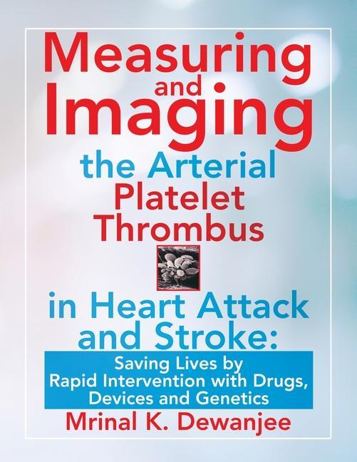 Knjiga Measuring and Imaging the Arterial Platelet Thrombus in Heart Attack and Stroke MRINAL K. DEWANJEE