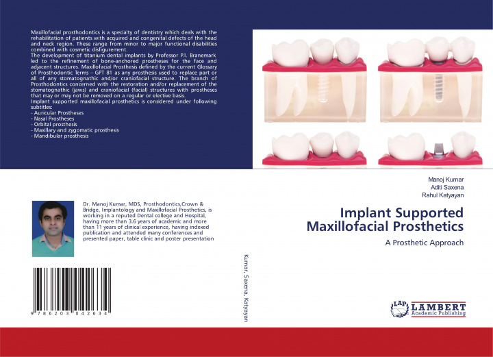 Könyv Implant Supported Maxillofacial Prosthetics MANOJ KUMAR