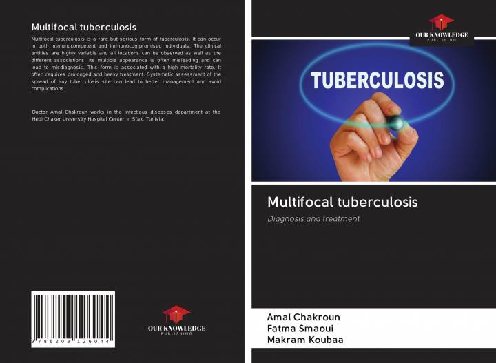 Knjiga Multifocal tuberculosis AMAL CHAKROUN