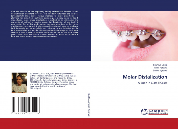 Knjiga Molar Distalization SOUMYA GUPTA