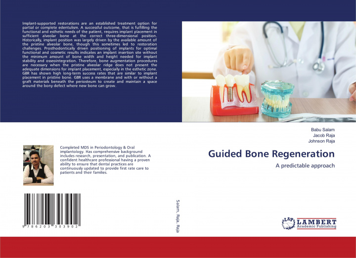 Könyv Guided Bone Regeneration BABU SALAM