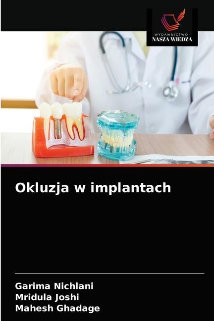 Könyv Okluzja w implantach Nichlani Garima Nichlani