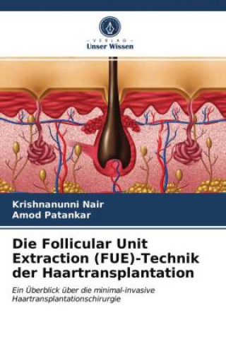 Kniha Follicular Unit Extraction (FUE)-Technik der Haartransplantation Nair Krishnanunni Nair