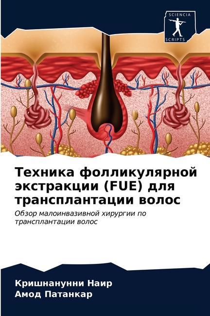 Libro Техника фолликулярной э& ÐÐ°Ð¸Ñ€ ÐšÑ€Ð¸ÑˆÐ½Ð°Ð½ÑƒÐ½Ð½Ð¸ ÐÐ°Ð¸Ñ€
