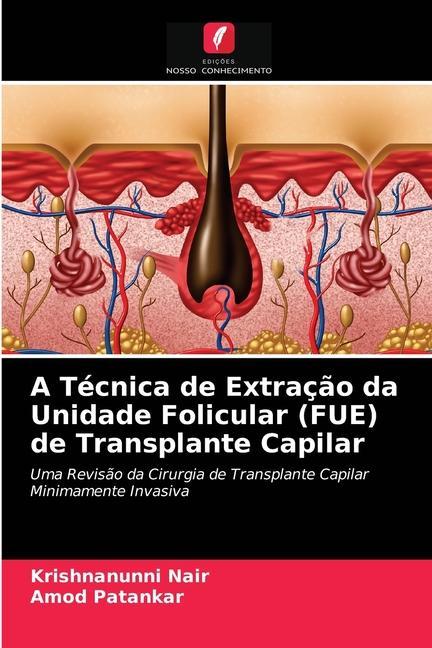 Kniha Tecnica de Extracao da Unidade Folicular (FUE) de Transplante Capilar Nair Krishnanunni Nair