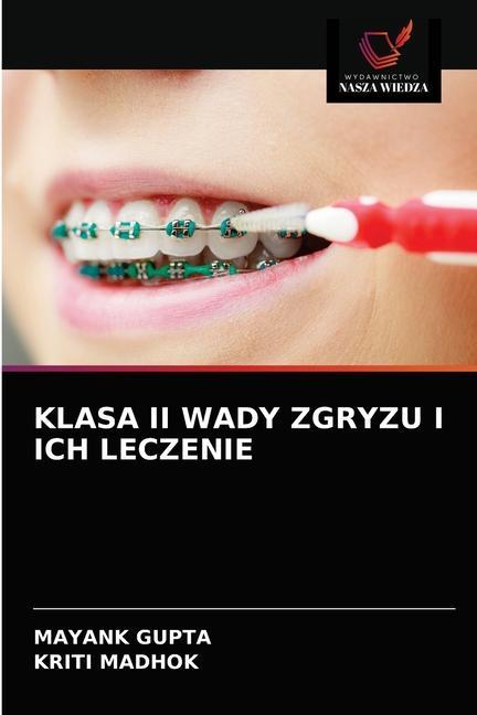Book Klasa II Wady Zgryzu I Ich Leczenie GUPTA MAYANK GUPTA