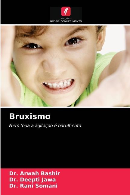 Knjiga Bruxismo Bashir Dr. Arwah Bashir