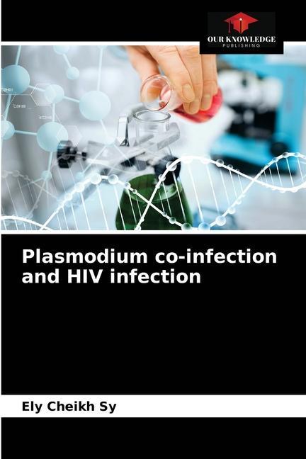 Kniha Plasmodium co-infection and HIV infection Sy Ely Cheikh Sy