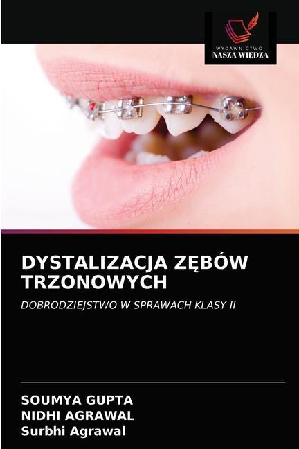 Knjiga Dystalizacja ZĘbow Trzonowych Gupta Soumya Gupta