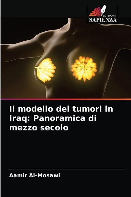 Boek modello dei tumori in Iraq Al-Mosawi Aamir Al-Mosawi