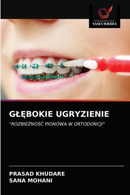 Kniha GlĘbokie Ugryzienie Khudare Prasad Khudare