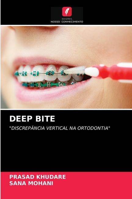 Libro Deep Bite Khudare Prasad Khudare