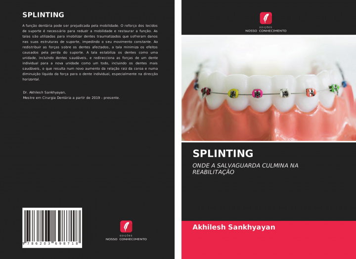 Knjiga Splinting AKHILESH SANKHYAYAN