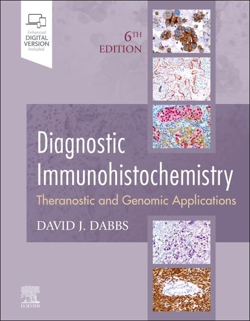 Kniha Diagnostic Immunohistochemistry David J Dabbs