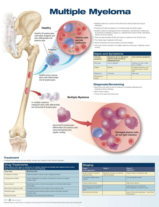 Kniha Multiple Myeloma Anatomical Chart Anatomical Chart Company