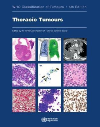 Książka Thoracic Tumours: Who Classification of Tumours 