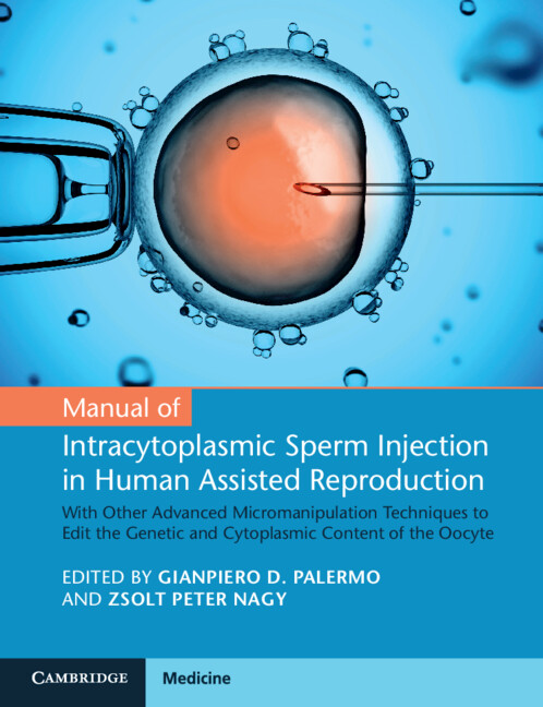 Kniha Manual of Intracytoplasmic Sperm Injection in Human Assisted Reproduction 