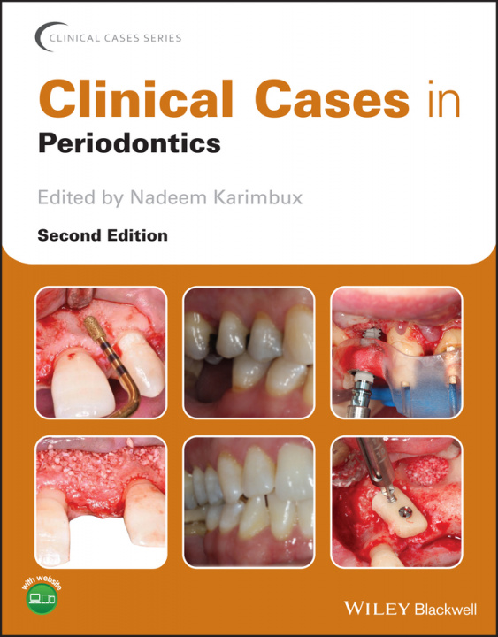 Kniha Clinical Cases in Periodontics 2e Nadeem Karimbux