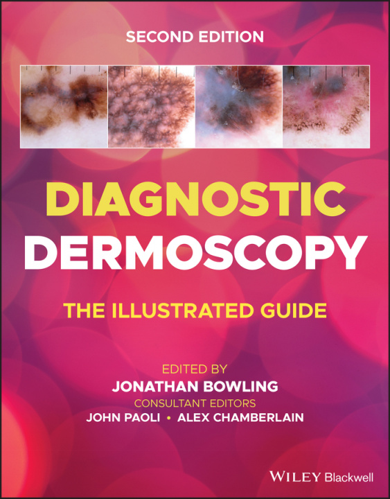 Carte Diagnostic Dermoscopy - The Illustrated Guide, 2e Jonathan Bowling