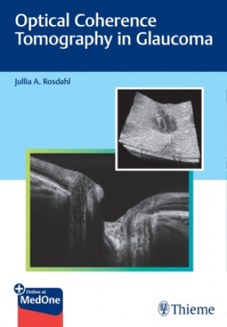 Kniha Optical Coherence Tomography in Glaucoma 