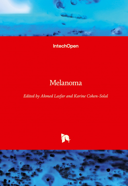 Knjiga Melanoma Karine Cohen-Solal
