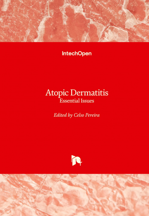 Knjiga Atopic Dermatitis Celso Pereira