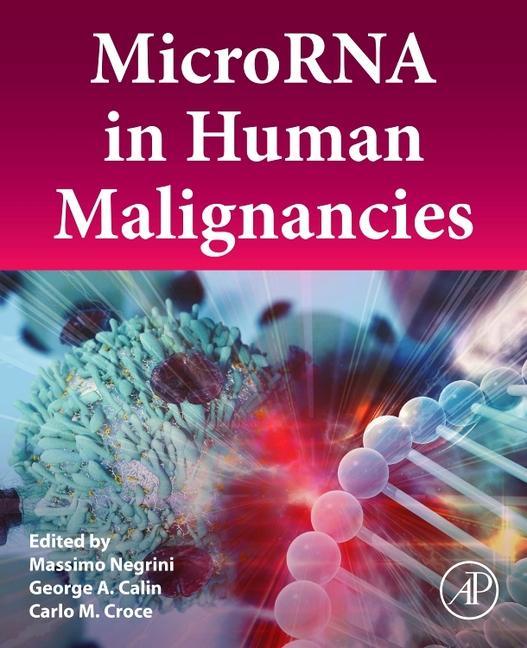 Kniha MicroRNA in Human Malignancies Massimo Negrini