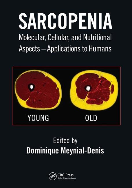 Kniha Sarcopenia Dominique Meynial-Denis