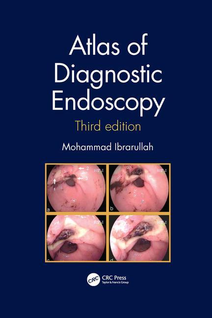 Książka Atlas of Diagnostic Endoscopy, 3E 