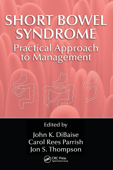 Knjiga Short Bowel Syndrome Practical Approach to Management Carol Rees Parrish
