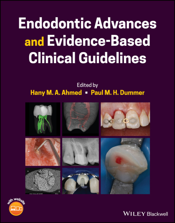 Carte Endodontic Advances and Evidence-Based Clinical Guidelines 