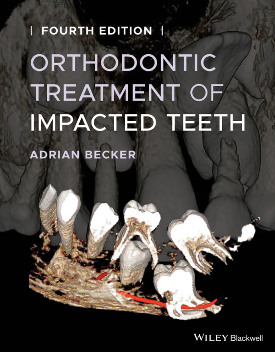 Книга Orthodontic Treatment of Impacted Teeth 4th Edition Adrian Becker