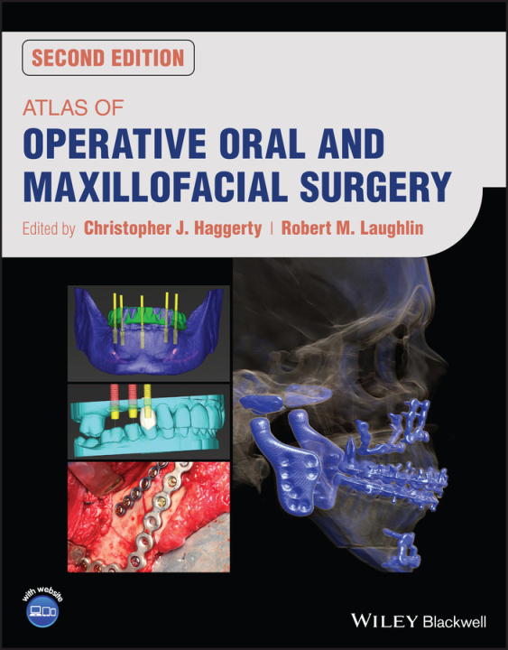 Kniha Atlas of Operative Oral and Maxillofacial Surgery 