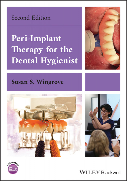 Könyv Peri-Implant Therapy for the Dental Hygienist 