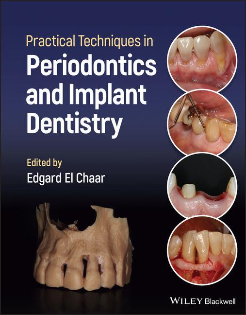 Книга Practical Techniques in Periodontics and Implant Dentistry 
