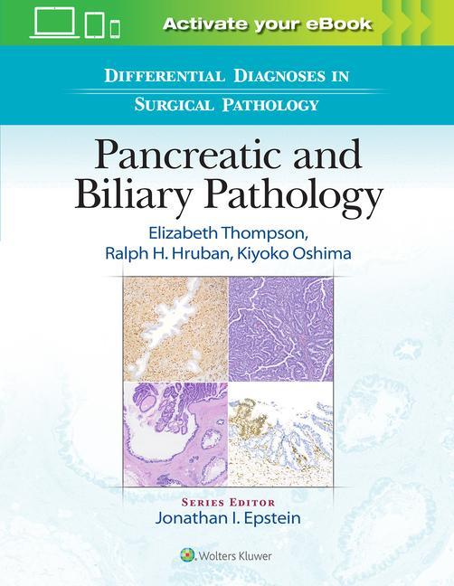 Buch Differential Diagnoses in Surgical Pathology: Pancreatic and Biliary Pathology Elizabeth Thompson