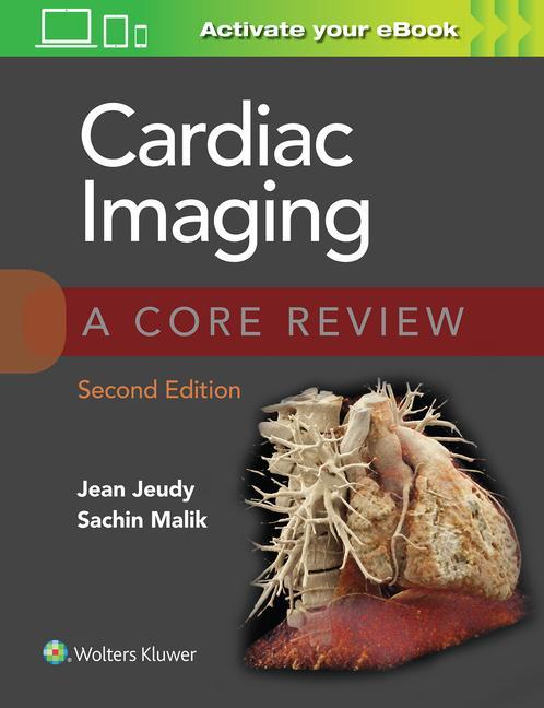 Könyv Cardiac Imaging: A Core Review Maliik Sachin