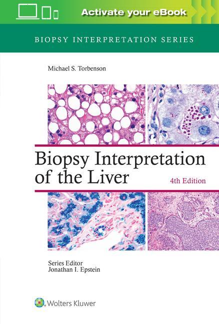 Książka Biopsy Interpretation of the Liver Torbenson