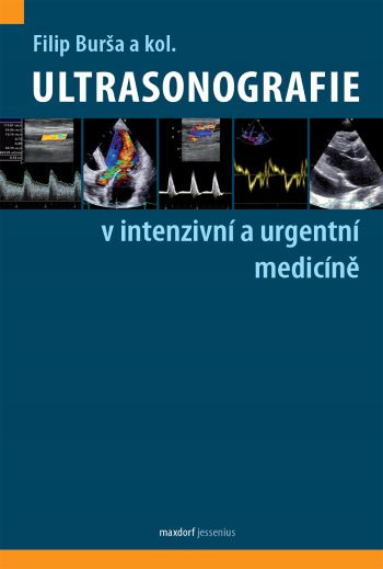 Kniha Ultrasonografie v intenzivní a urgentní medicíně Filip Burša a kol.